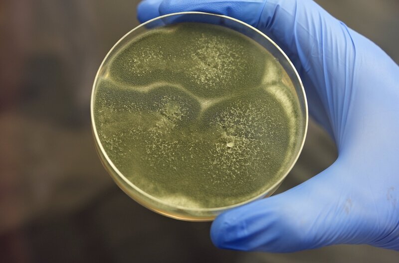 Im Labor machen sie Wissenschaftlerinnen und Wissenschaftler auf die Suche nach wirksamen Gegenmitteln gegen die gefährlichen Pilzkulturen. – Bild: SWR