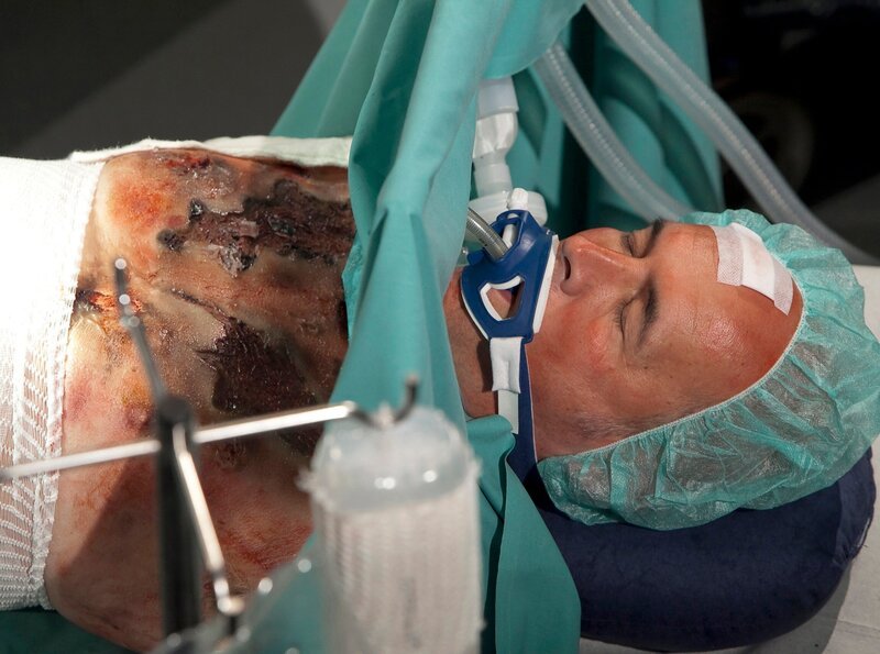 Gunther Mensing (Klaus Schindler) schwebt in Lebensgefahr. Der größte Teil seiner Haut ist verbrannt und er muss sofort operiert werden. Evelyn Mensing hat Dr. Roland Heilmann das Versprechen abgenommen, ihren Mann zu operieren. – Bild: MDR/​Peter Krajewsky