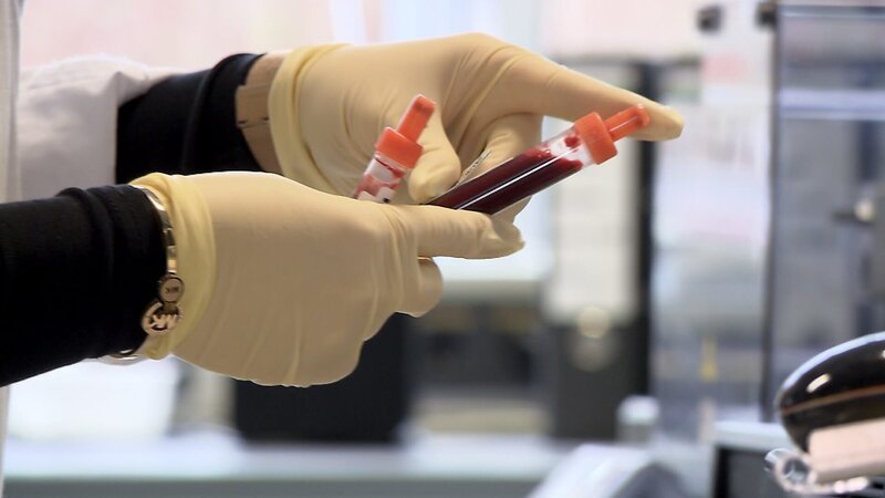 Seit Jahren sinkt die Grenze ab wann die Cholesterin- oder Zuckerwerte im Blut zu hoch sind. – Bild: ORF /​ Langbein & Partner