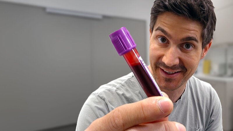 Einstein Moderator Tobias Müller hat sein Blut für einen Test abnehmen lassen. – Bild: SRF