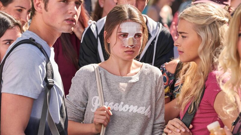 Jana (Zoe Moore, M.) kommt nach der Operation ihrer Nase mit einem Verband zurück in die Schule. – Bild: TVNOW /​ Frank Dicks