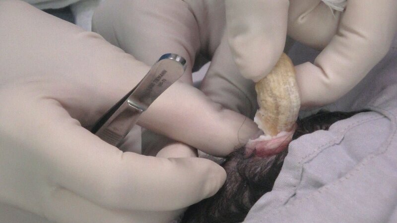 During surgery. – Bild: Warner Bros. Discovery