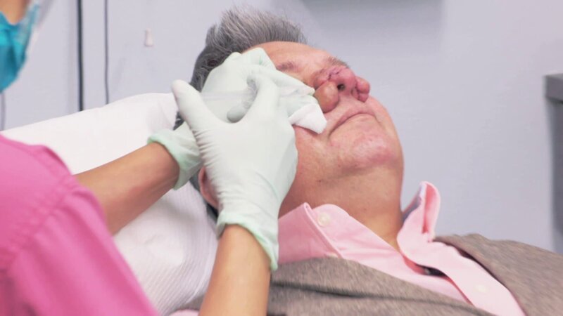 Tony feels like a monster and hardly dares to go out in public. His last hope is Dr. Lee. – Bild: Discovery