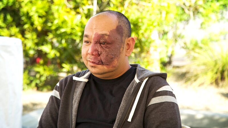 Nhan aus Vietnam kam mit einem riesigen Feuermal im Gesicht zur Welt. – Bild: Warner Bros. Discovery