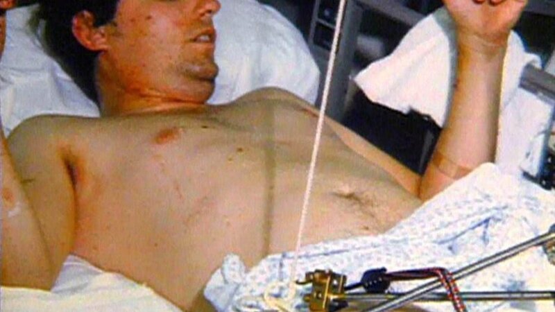 Mark Hofman verletzt sich durch seine eigene Bombe. – Bild: RTL