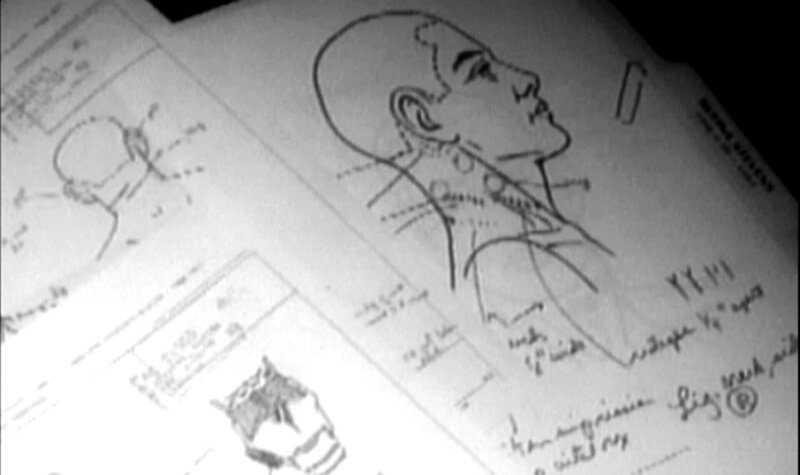 Am Hals der toten Rafina Stevens finden die Gerichtsmediziner auffällige Würge-Merkmale.. – Bild: RTL Zwei