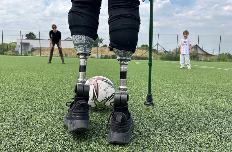 In der Ukraine gibt es durch den russischen Angriffskrieg mittlerweile Zehntausende von Amputationsverletzten, vor allem unter Soldaten. Das stellt die ukrainische Gesellschaft vor riesige Probleme. „Unser Land ist nicht auf Menschen wie uns vorbereitet“, sagt Vitalii Saiko-Kazakow, der selbst an der Front schwer verwundet wurde. – Vitalii kann mit seinem Sohn wieder Fußball spielen. – Bild: WDR/Michael Günther In der Ukraine gibt es durch den russischen Angriffskrieg mittlerweile Zehntausende von Amputationsverletzten, vor allem unter Soldaten. Das stellt die ukrainische Gesellschaft vor riesige Probleme. „Unser Land ist nicht auf Menschen wie uns vorbereitet“, sagt Vitalii Saiko-Kazakow, der selbst an der Front schwer verwundet wurde. – Vitalii kann mit seinem Sohn wieder Fußball spielen. – Bild: WDR/Michael Günther