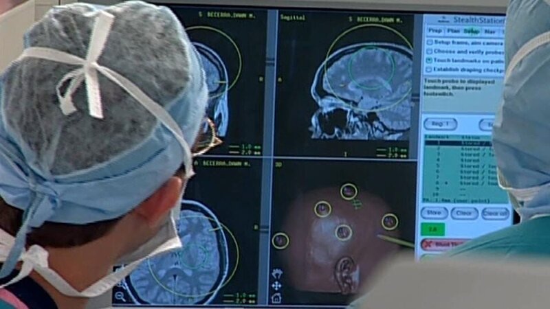 Bei Erwachsenen verläuft eine Cytomegalie in der Regel völlig harmlos. Bei Kleinkindern, deren Immunsystem noch nicht vollständig entwickelt ist, können jedoch lebensbedrohliche Krankheitsbilder auftreten – wie im Fall der elf Monate alten Lilian im US-Bundesstaat Texas. Das Mädchen leidet unter heftigen Anfällen, denn die Herpesviren sind in ihre Gehirnzellen eingedrungen. Mit Medikamenten ist den Parasiten dort nicht beizukommen, deshalb greifen Dr. Gail Harrison und ihre Medizinerkollegen in dieser Folge zu drastischen Maßnahmen. – Bild: Animal Planet