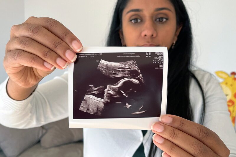 Puls - Pränatale Diagnostik - Eltern im Dilemma. „Puls“-Host Tama James-Vakeesan, die eine Aufnahme eines Ultraschallscreens zeigt. – Bild: SRF1