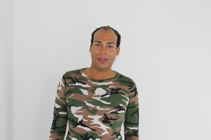 Der 26-jährige Romarni leidet unter Haarausfall. Nun hofft er auf die Hilfe der Body Fixers … – Bild: Studio Lambert & all3media Int.