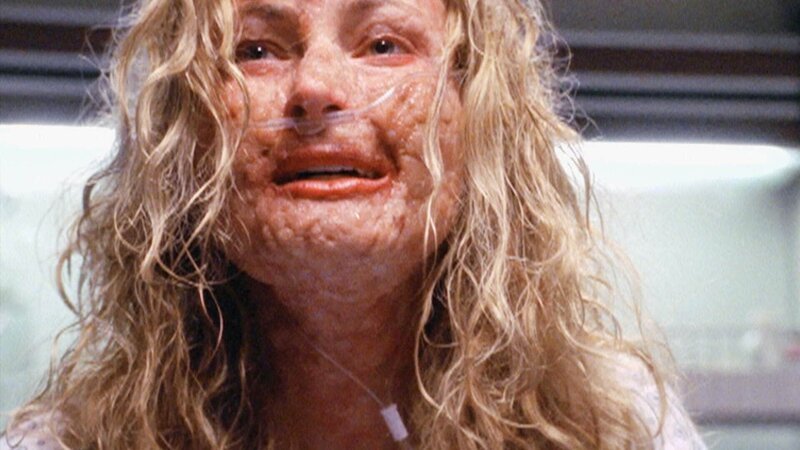 Hat die schöne Lisa Ross (Elizabeth Hobgood) dioxinverseuchtes Kokain zu sich genommen? – Bild: MG RTL D