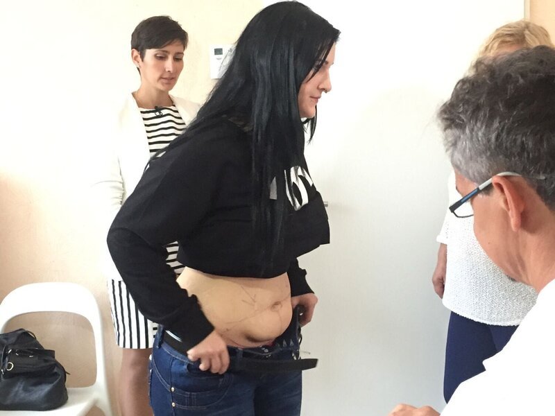 Bauchstraffung in Ungarn – Bild: ATV