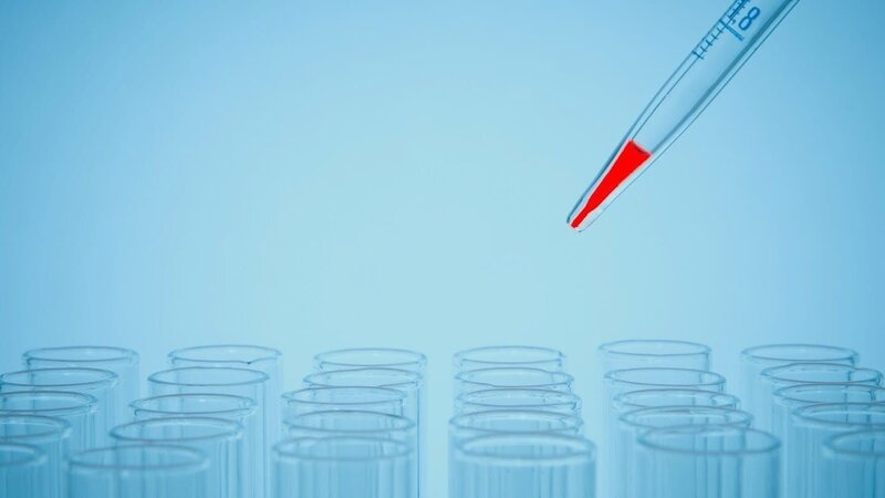 Die Untersuchung in einem Labor – Bild: A+E NETWORKS