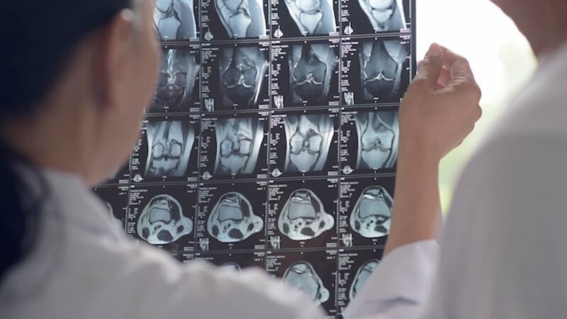 Das Bild zeigt einen Magnetresonanztomographie-Scan (MRT). – Bild: CuriosityStream-Inc.