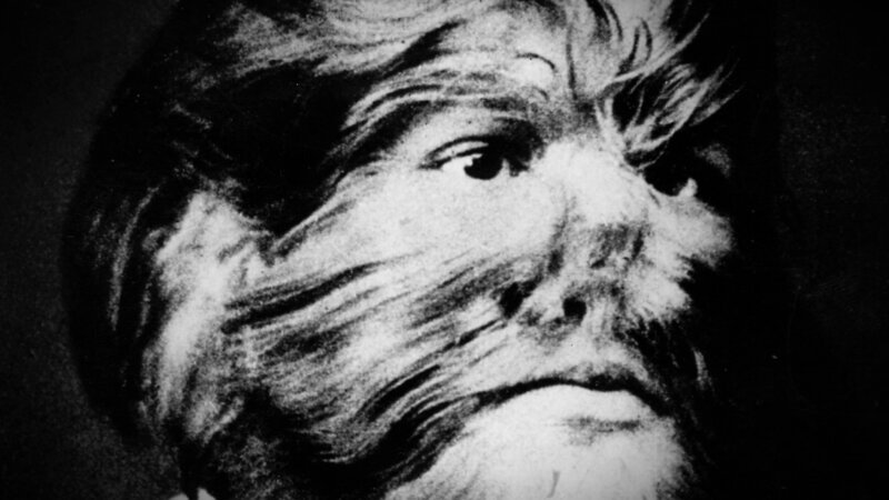 JoJo, der „Junge mit dem Hundegesicht“ (1900) – Bild: uklibscre /​ THE HISTORY CHANNEL /​ A+E Global Media