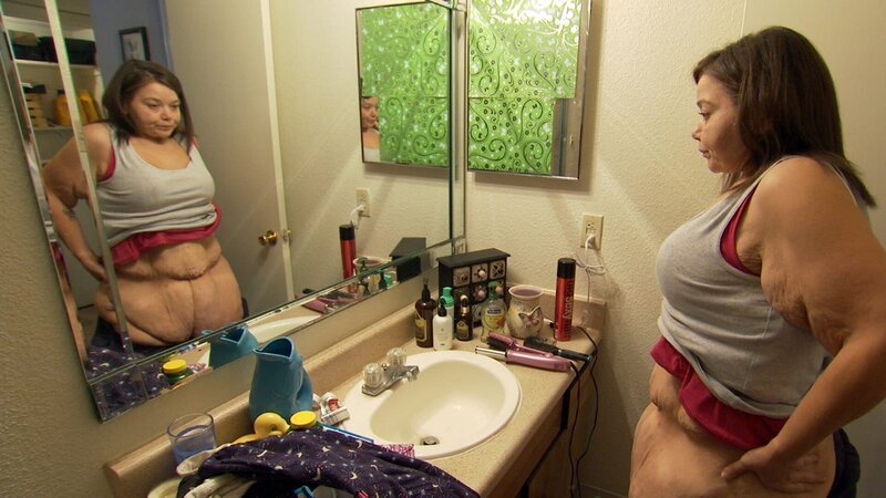 Brittani looks at her excess stomach skin before she has it removed surgically. – Bild: TLC /​ Discovery Communications