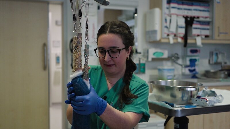 Ungewöhnliche Methode: Eine Pflegefachkraft richtet mit einer speziellen Zugvorrichtung den gebrochenen Arm einer Patientin ein. – Bild: ZDF