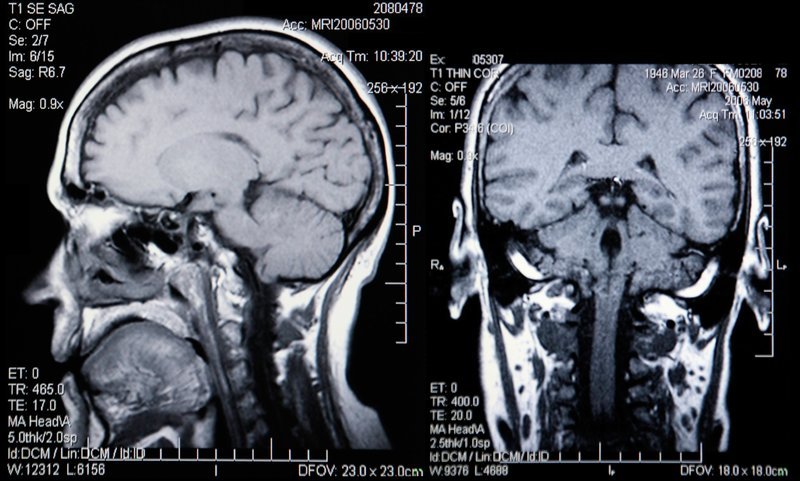 Brain scans – Bild: Depositphotos