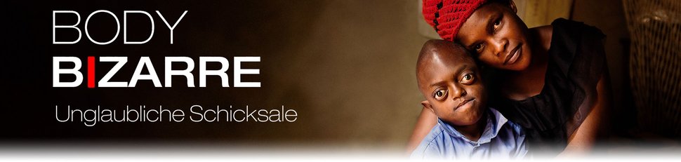 Body Bizarre – Unglaubliche Schicksale