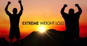 Extreme Weight Loss – Bild: ABC Extreme Weight Loss – Bild: ABC
