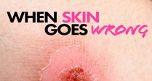 When Skin Goes Wrong – Bild: TLC When Skin Goes Wrong – Bild: TLC